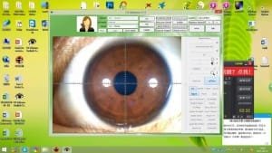 Estaci N De Iridolog A Software Here S A Quick Way To It Iriscope