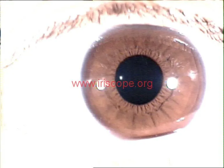 left iridology images