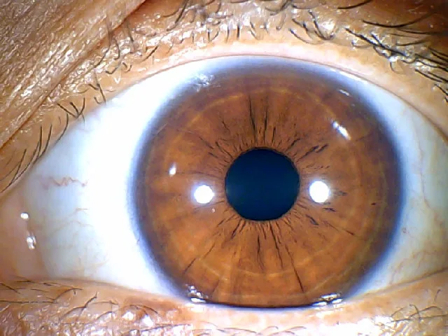 iridology hazel eyes