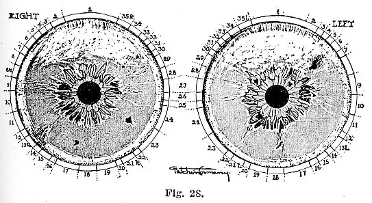 IRIDOLOGY -eyes ebook PDF download
