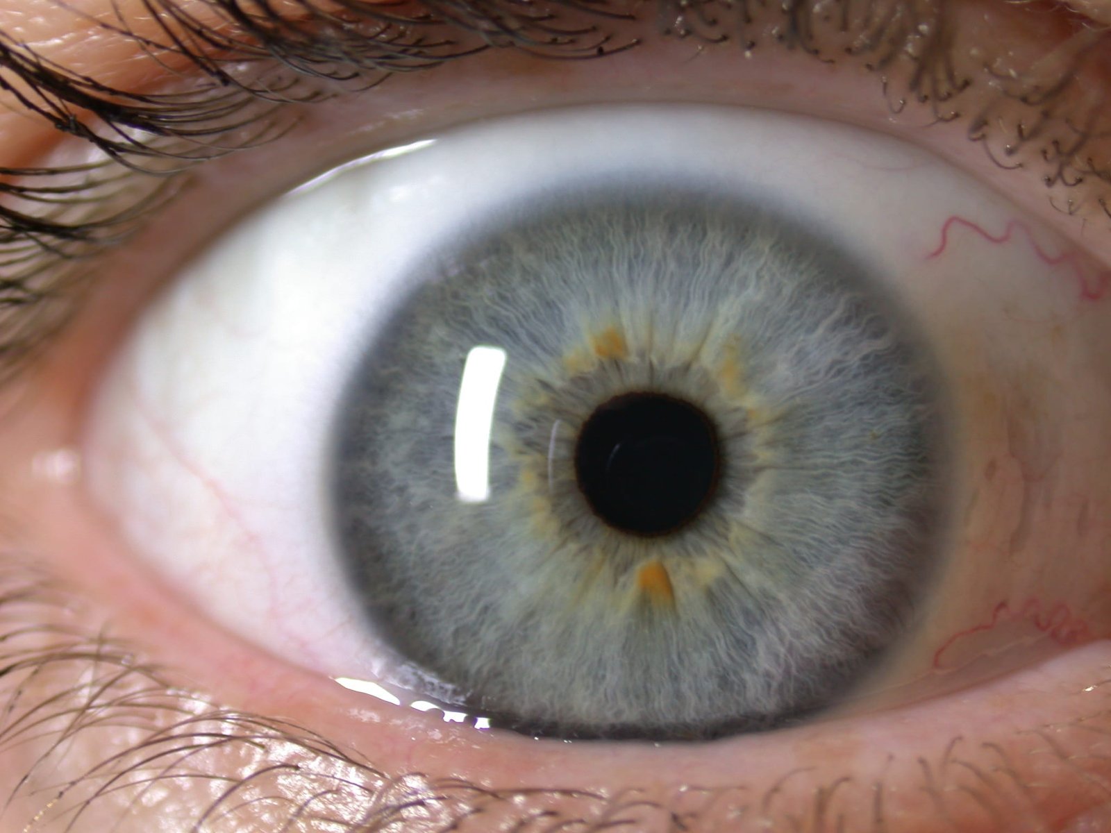 What Reasons Why iridology nyc is a Good Idea 3