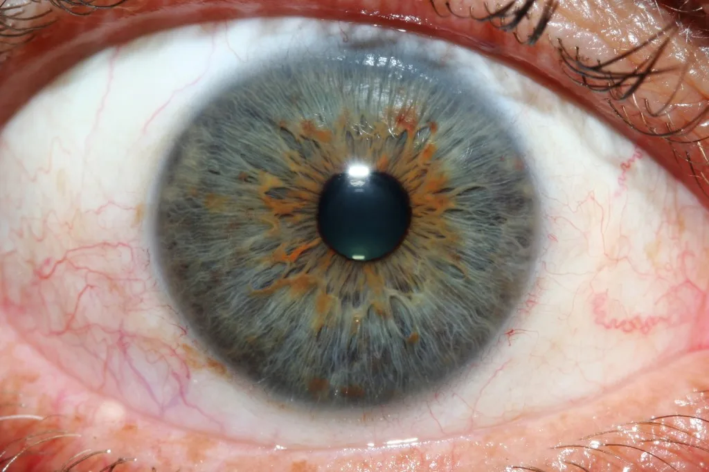 iridology eys images 1