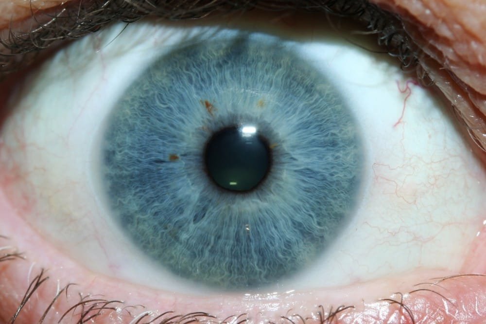 iridology images 1