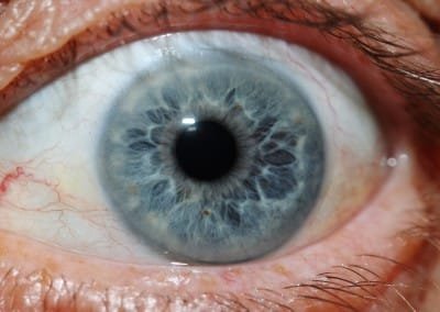 iridology images 27