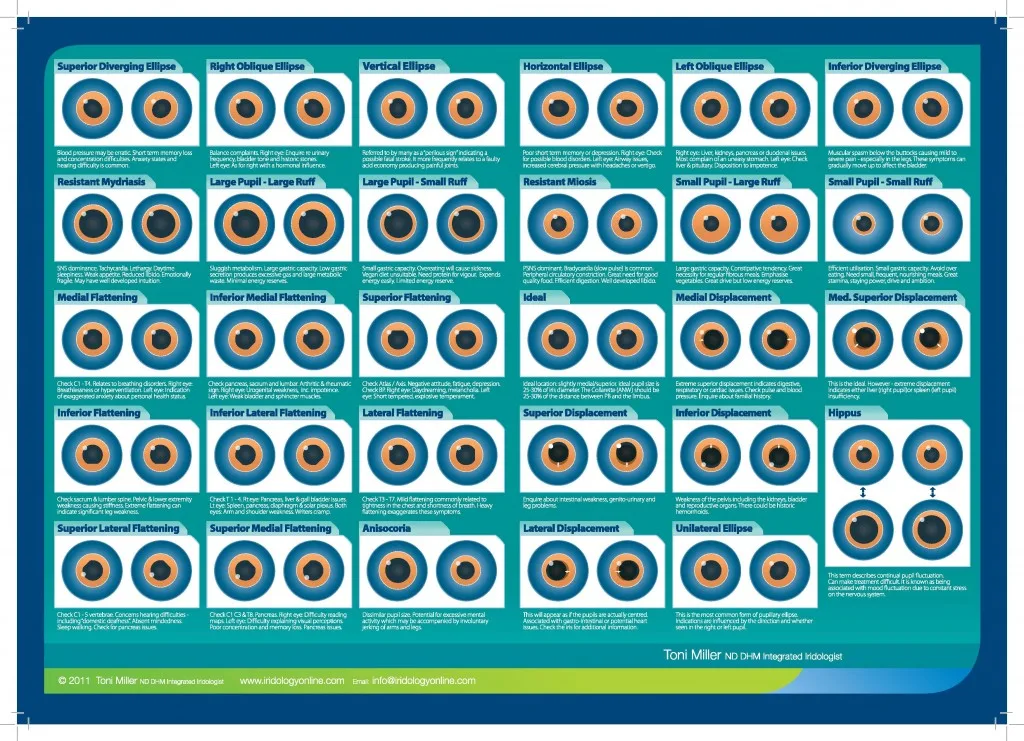 toni miller iridology reading