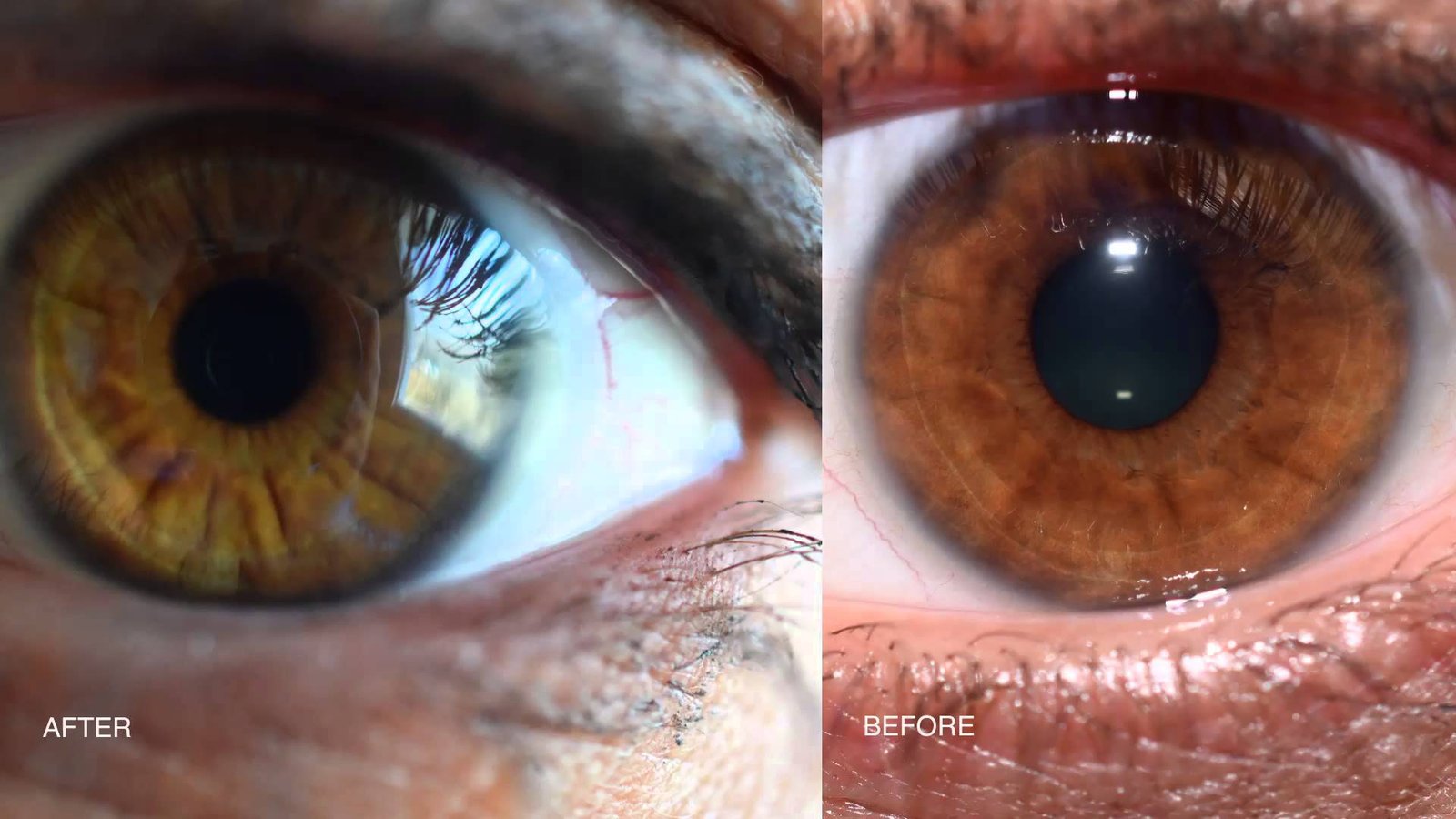Rapporto di analisi iridologicaes Changing Eye Color Mean for Your Health? 5 Iridology Analysis Report