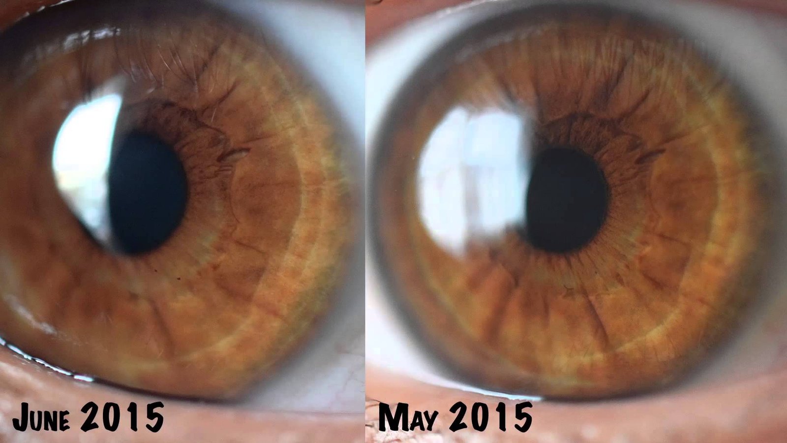 Iridology Analysis Report