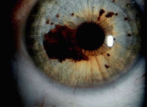 Iridology How to Change Eye Color: Understanding the Science Behind Iris Analysis 1 Close-up of human iris showing intricate color patterns and structures