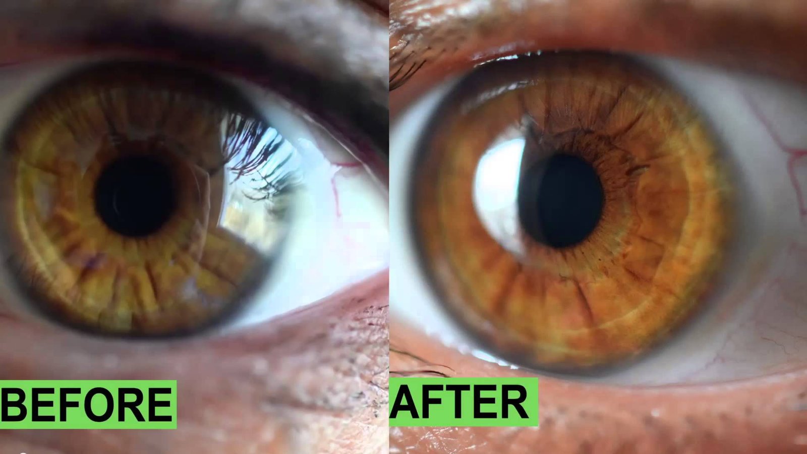 Iridology Analysis Report