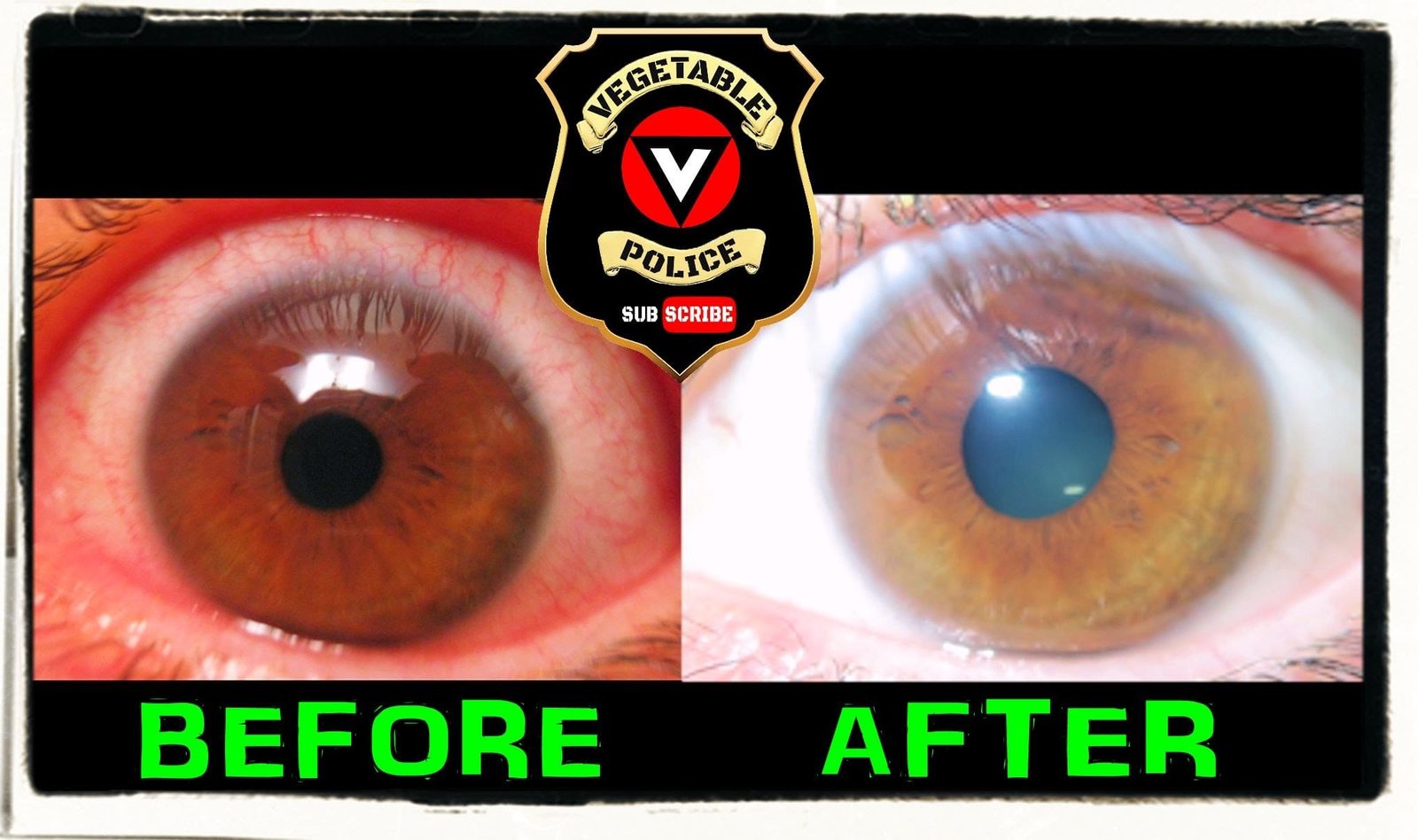 Iridology before and after comparison showing iris changes