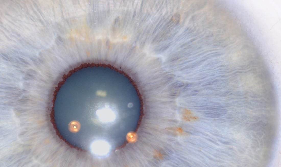 Iridology