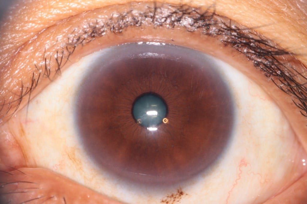 Qu'est-ce que le tableau des yeux? 7 iridología 46