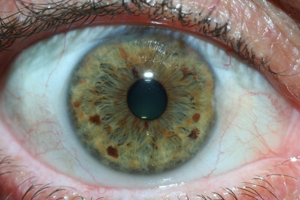 Behavioral Iridology
