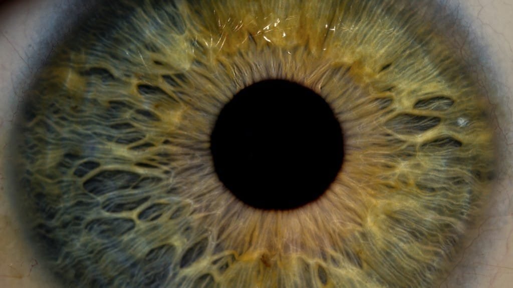iridology images 14