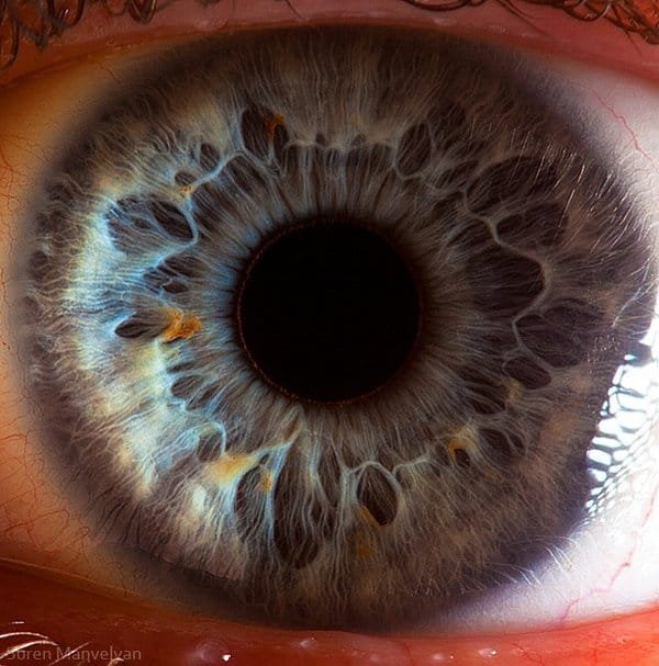 Read iridology chart