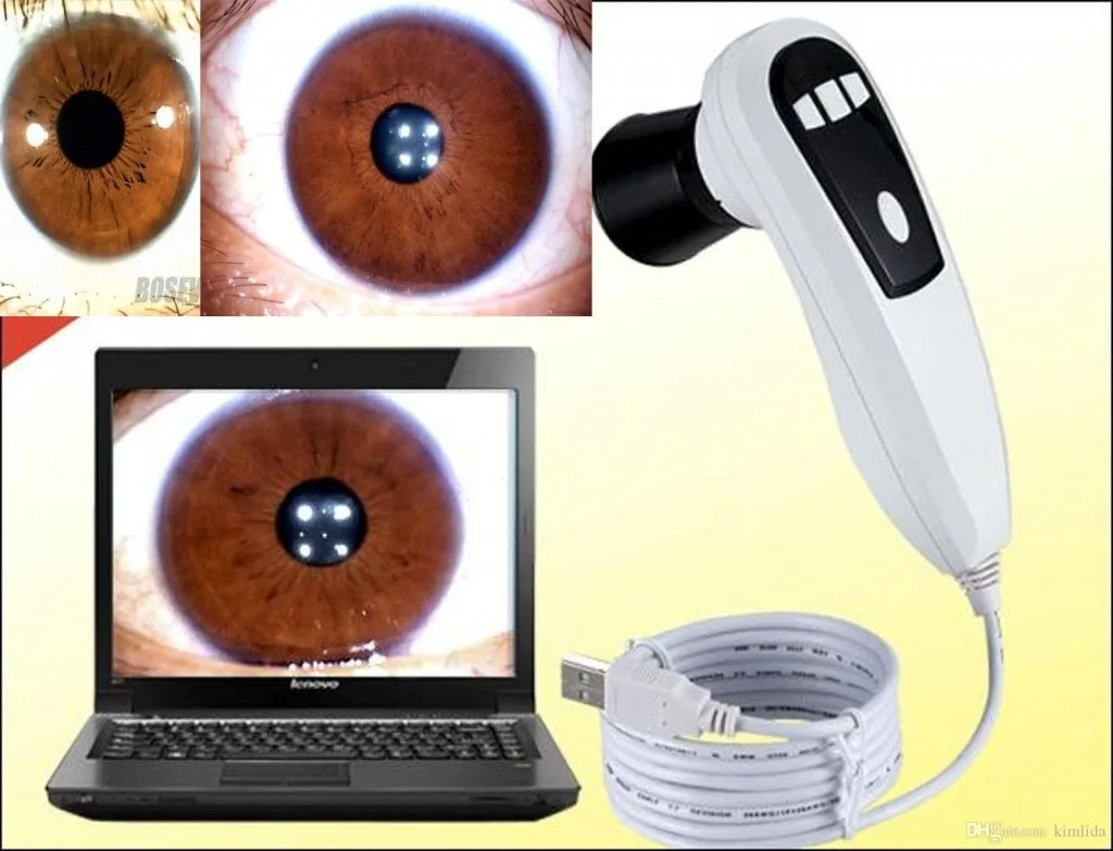 bernard jensen iridology camera