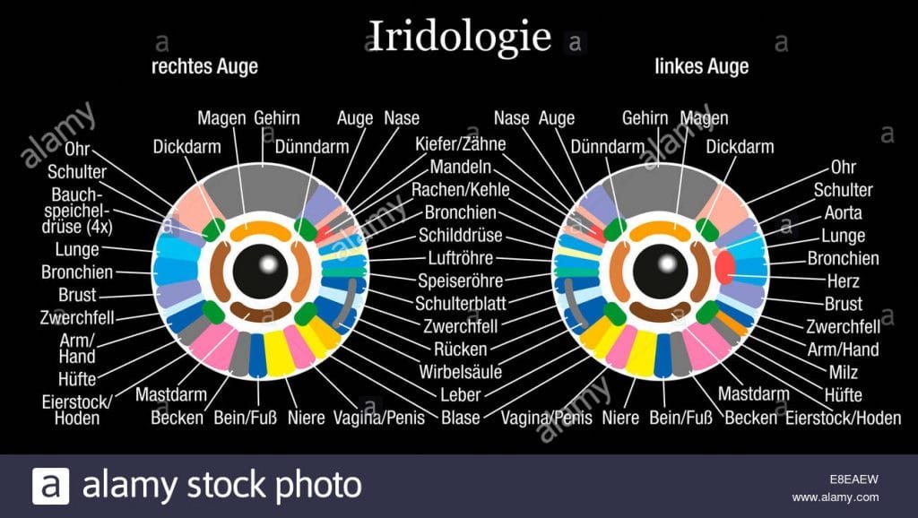 dx code for miotic pupil