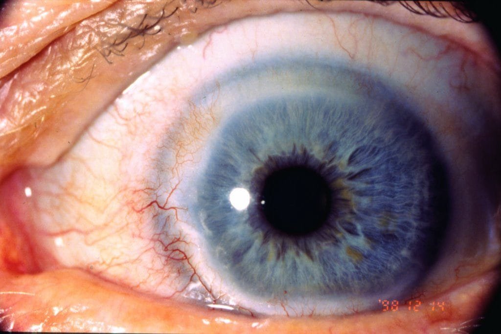 What is iris chart iridology how read iris chart iridology? 16 iridology pictures 1