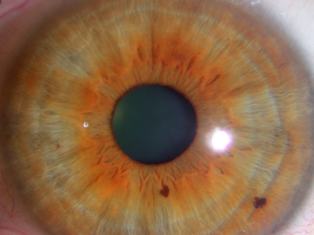 imagini de iridologie 8Here’s a Quick Way to download (10 pc) 20 iridology pictures 8