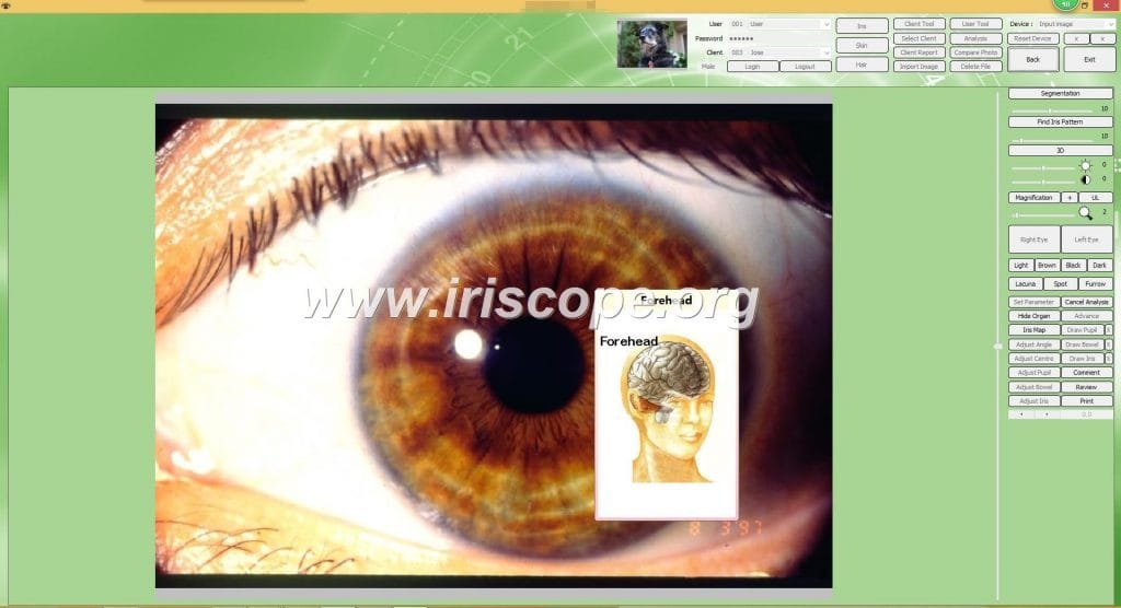 10 Best iridology camera australia for iridology camera