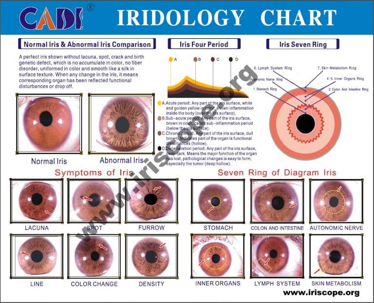 Iridology Diagnosis Chart