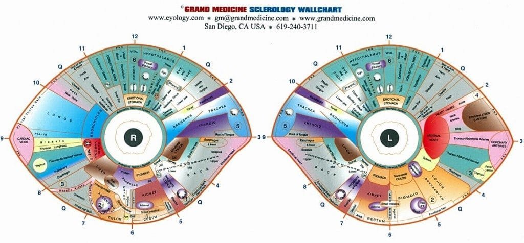 iridology diagnosis chart 14