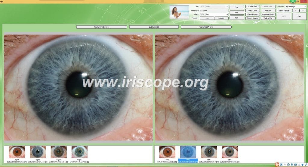 Iridology Camera Software How To Use It? – MAIKONG Iridology Camera ...