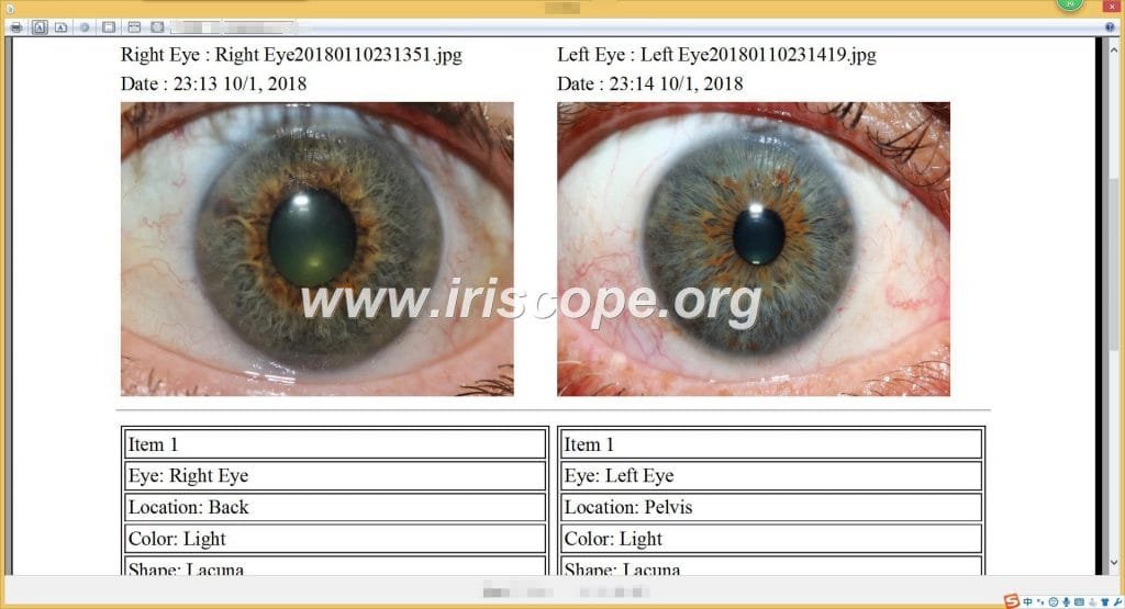 iriscopio 12 megapixeles 16 iriscopio 12 megapixeles
