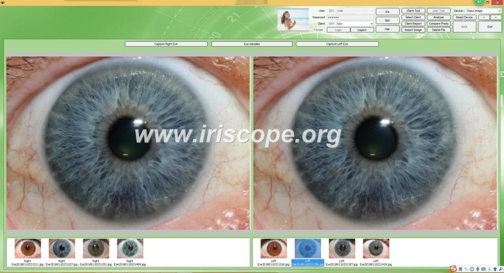 iriscopio 12 megapixeles
