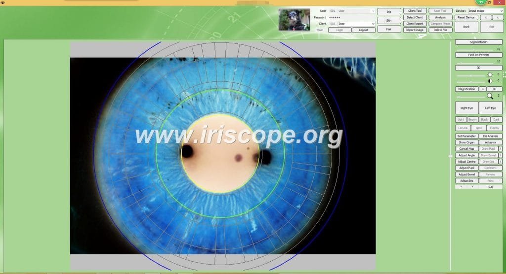 iriscopio en uruguay