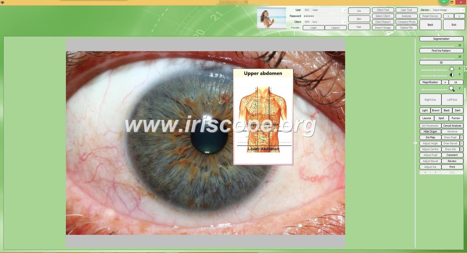 maikong iridology software