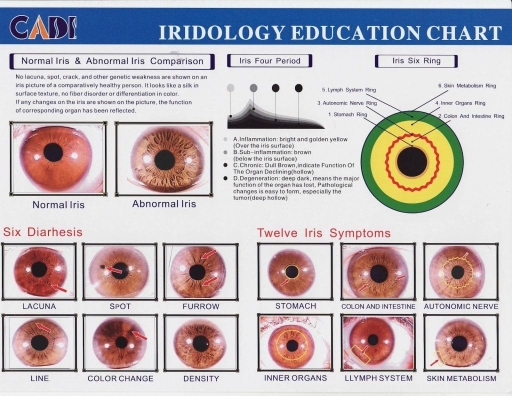 free iridology chart