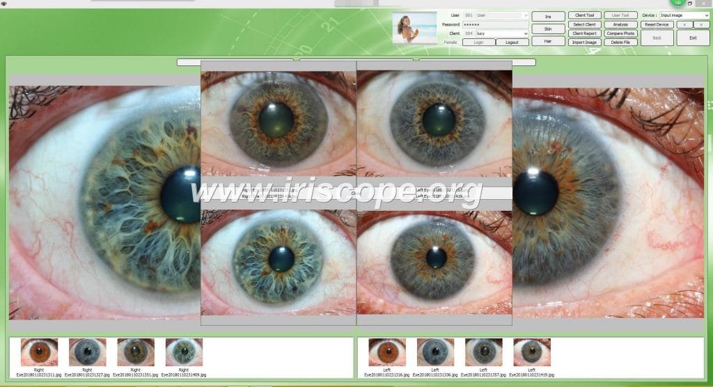 Software Para Iriscopio3