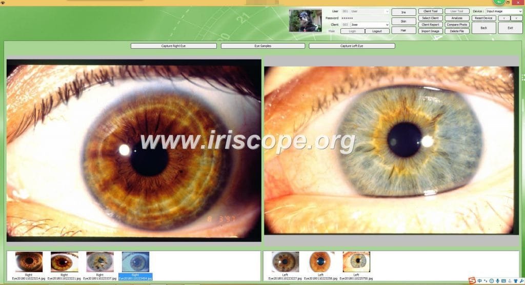 Dino Lite Iriscope