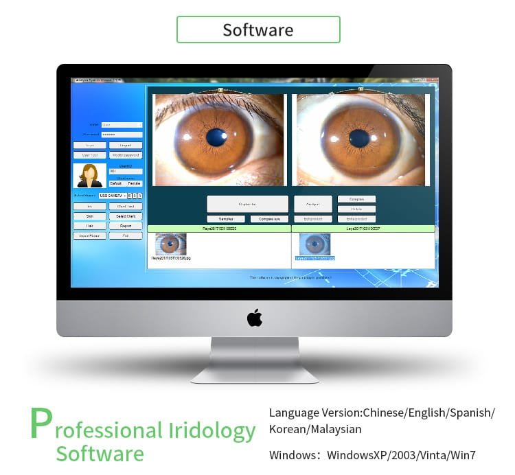 Types of Iridology Camera Used by Professionals 4 camera iridology