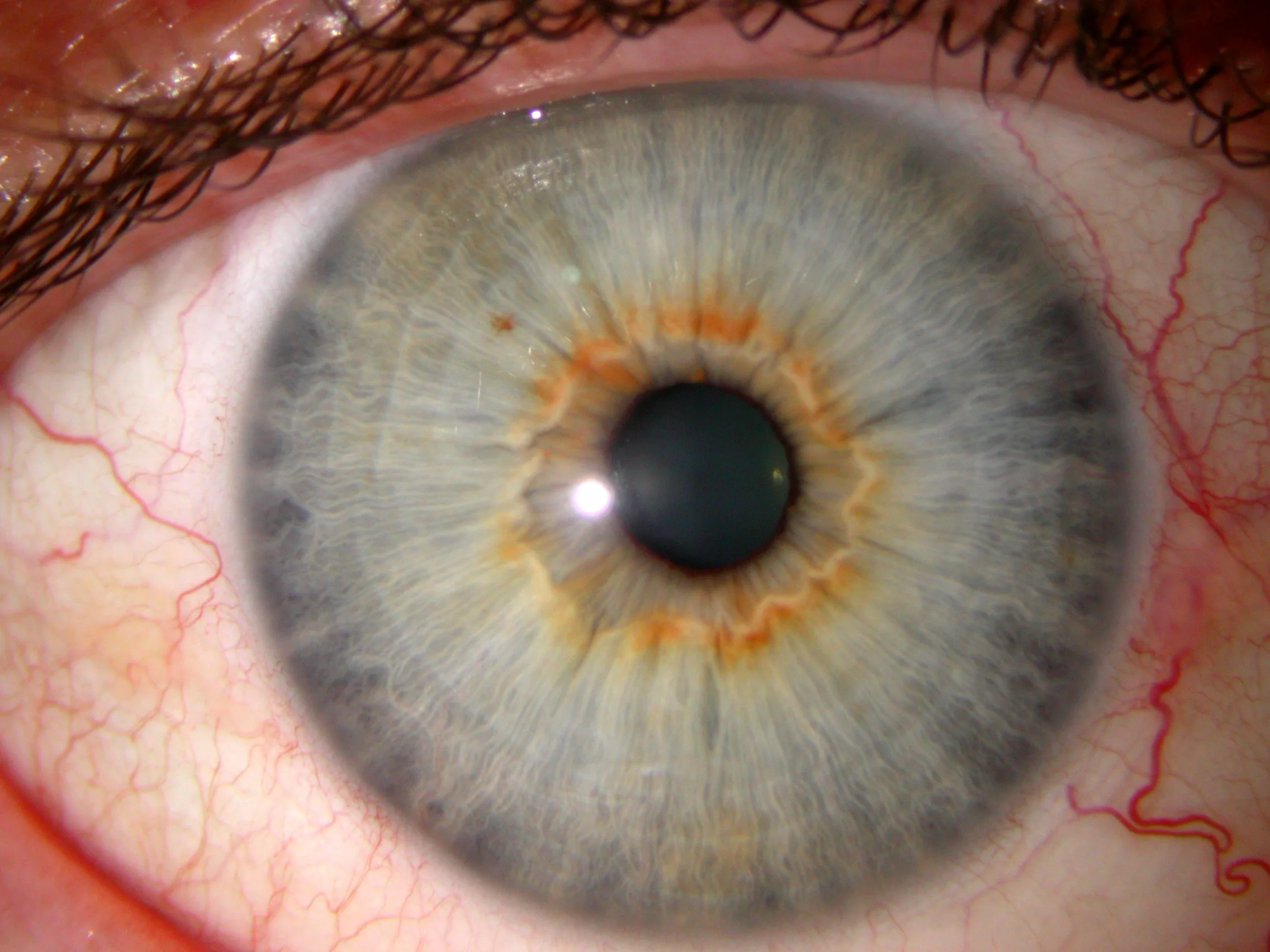 Iridology Camera Software