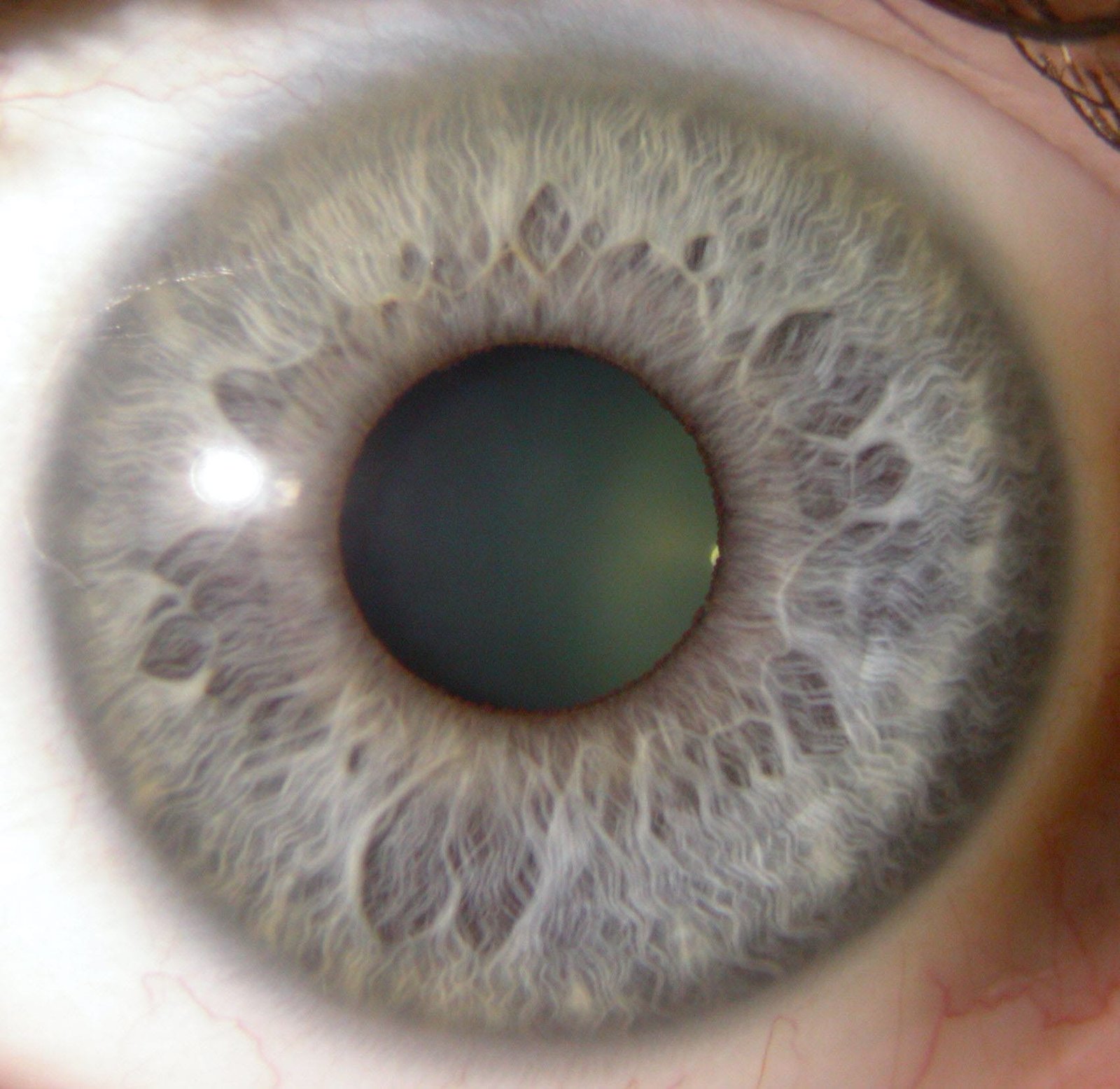 Iridology Camera and Software