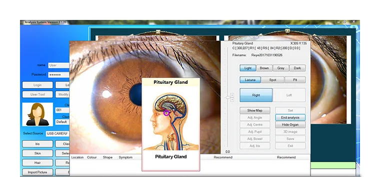 USB Camera Software Iridology: A Revolutionary Tool for Health Analysis