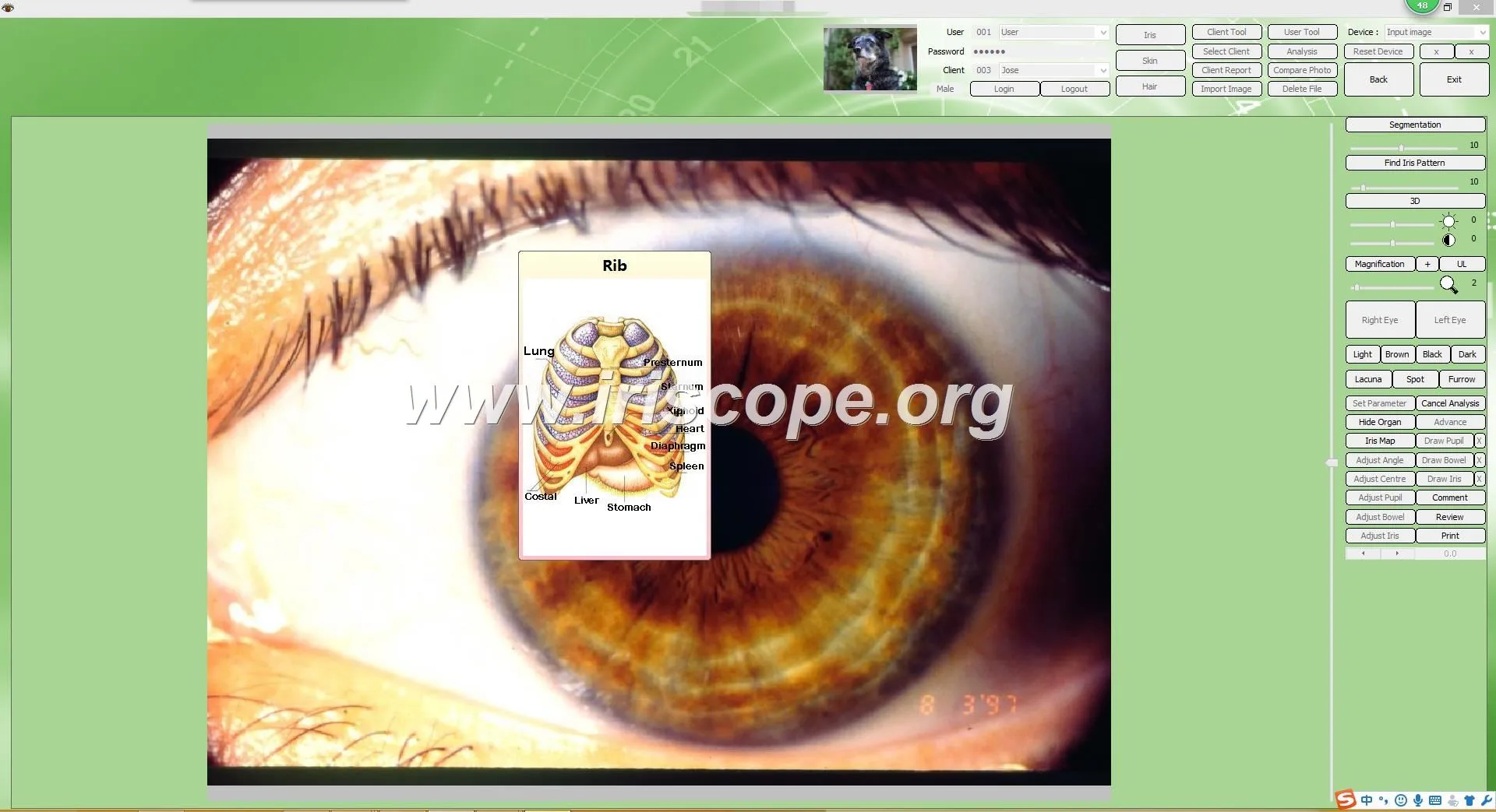 USB Camera Software Iridology: A Revolutionary Tool for Health Analysis