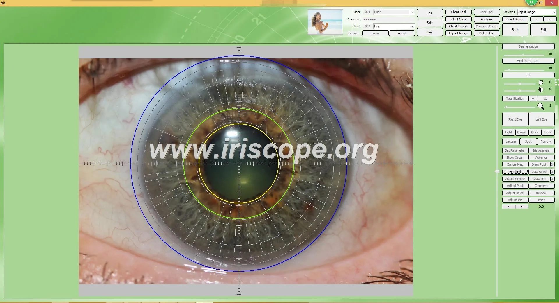USB Camera Software Iridology: A Revolutionary Tool for Health Analysis