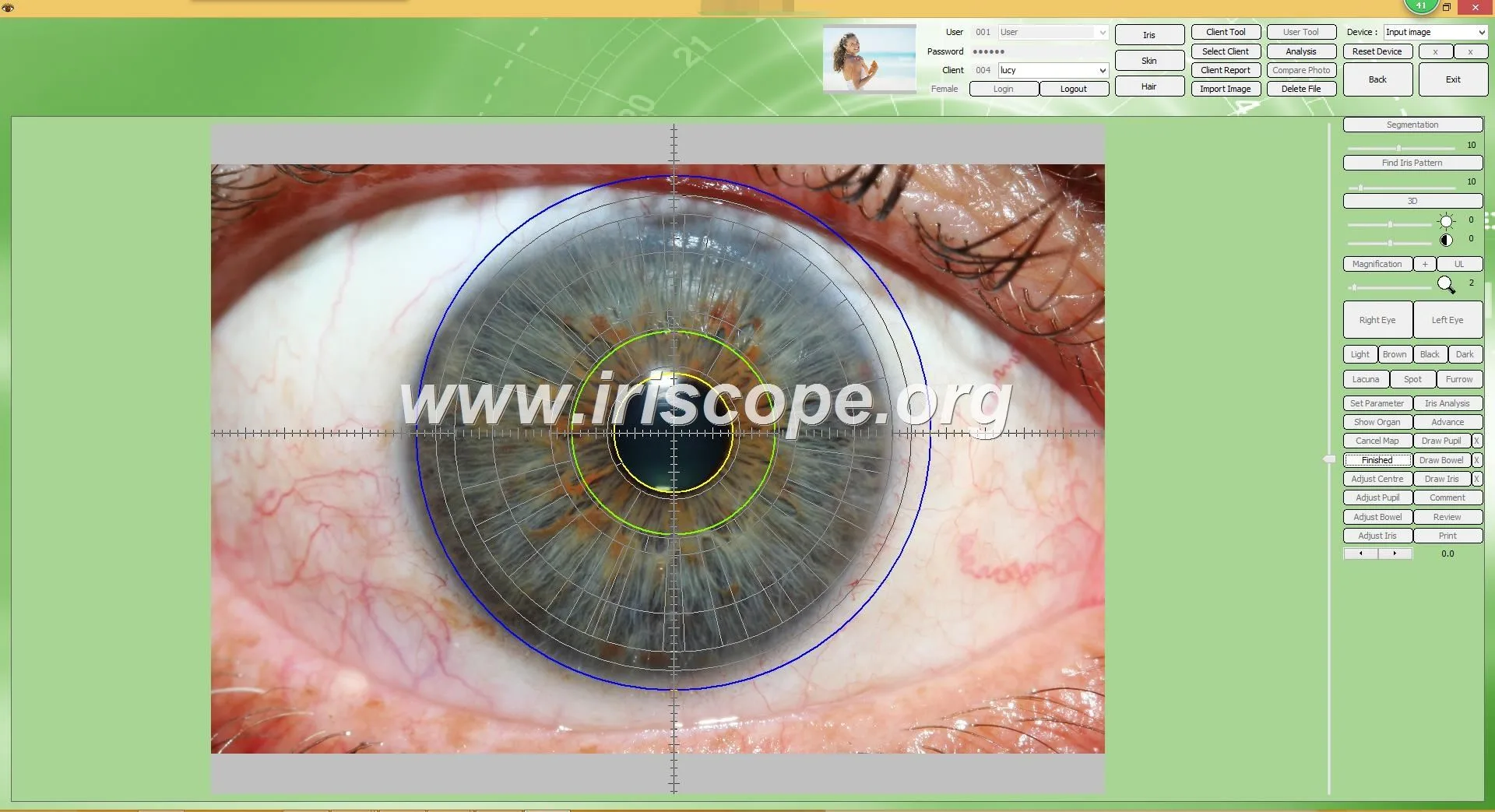 USB Camera Software Iridology: A Revolutionary Tool for Health Analysis