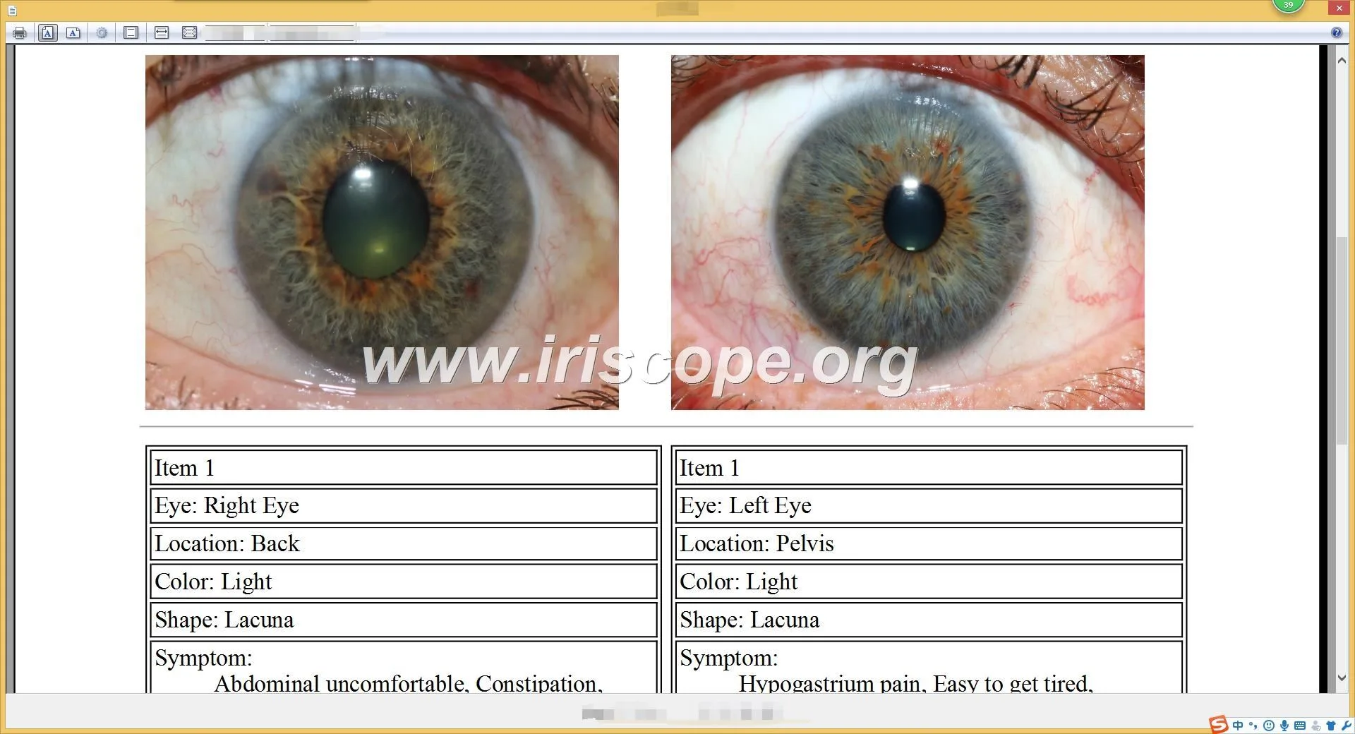 USB Camera Software Iridology: A Revolutionary Tool for Health Analysis