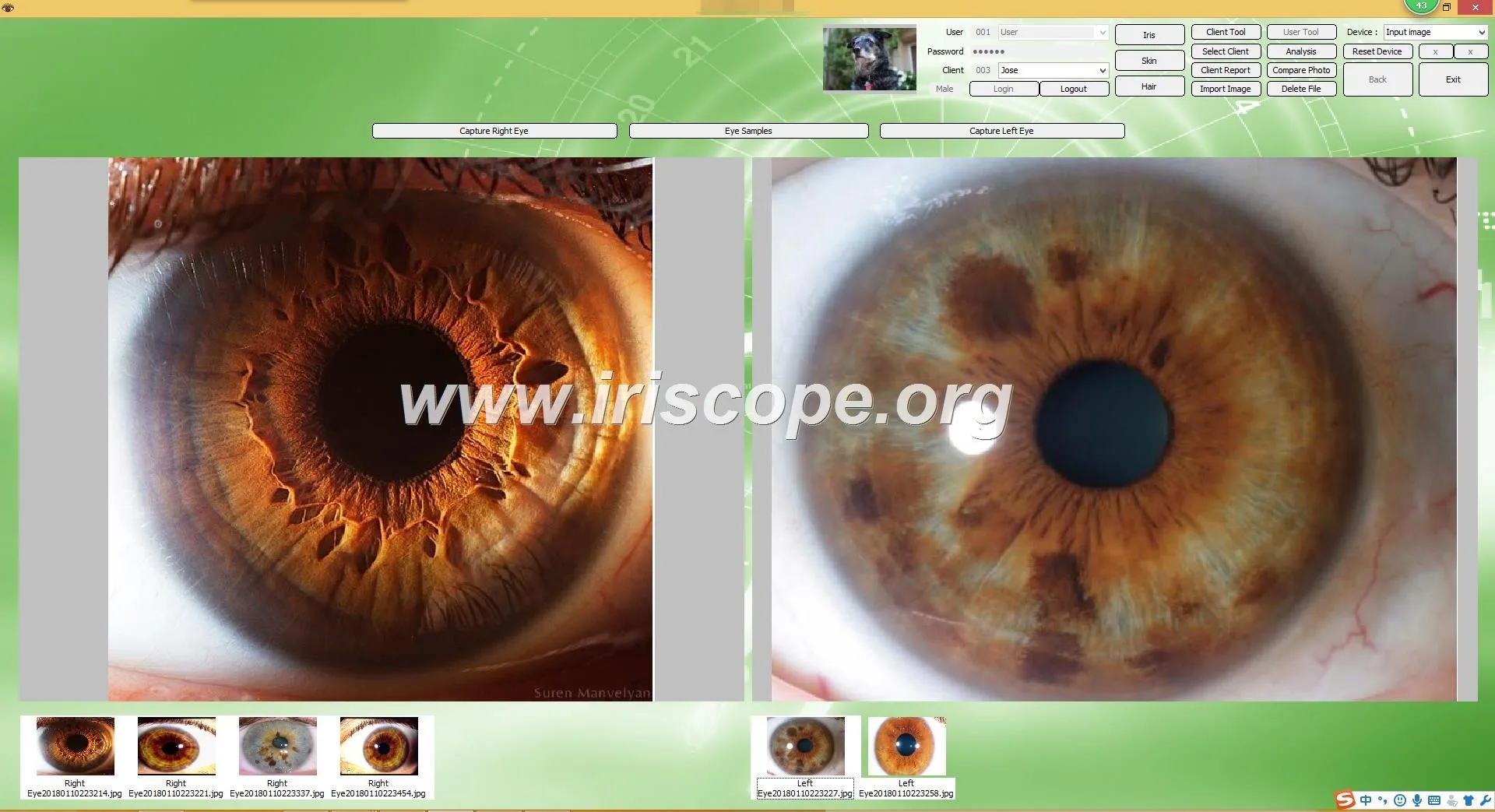 USB Camera Software Iridology: A Revolutionary Tool for Health Analysis