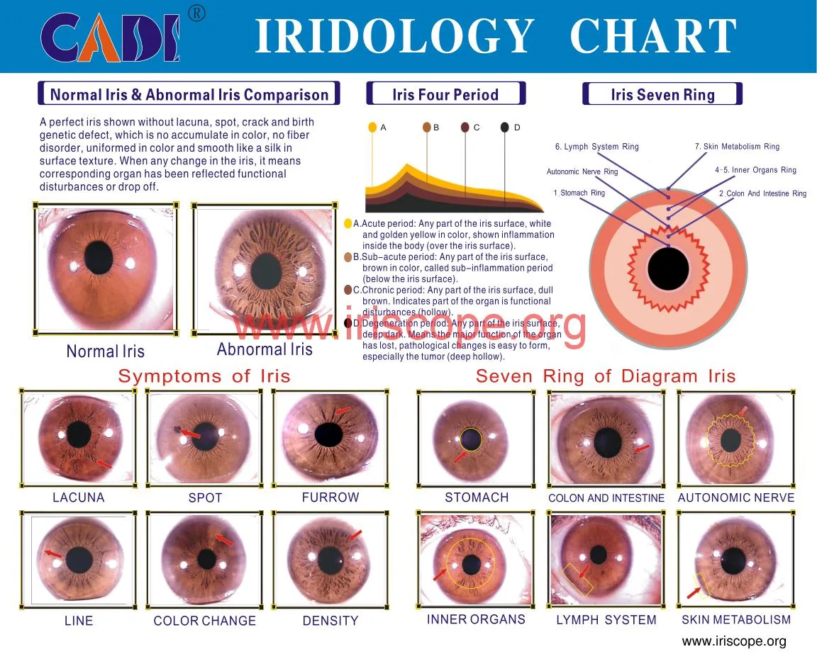 USB Camera Software Iridology: A Revolutionary Tool for Health Analysis