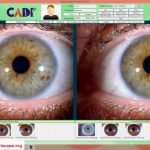 MAIKONG Iridology Camera App