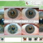 MAIKONG Iridology Camera App