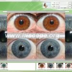 iridology camera for eyes