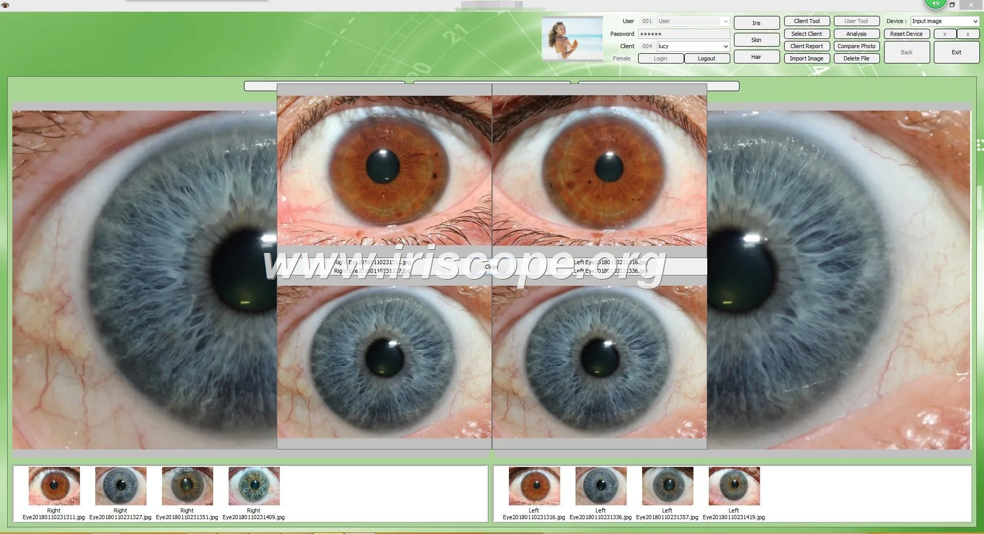 iridology camera for eyes