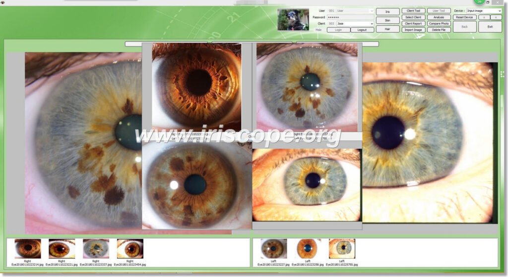 Iridology Camera Software