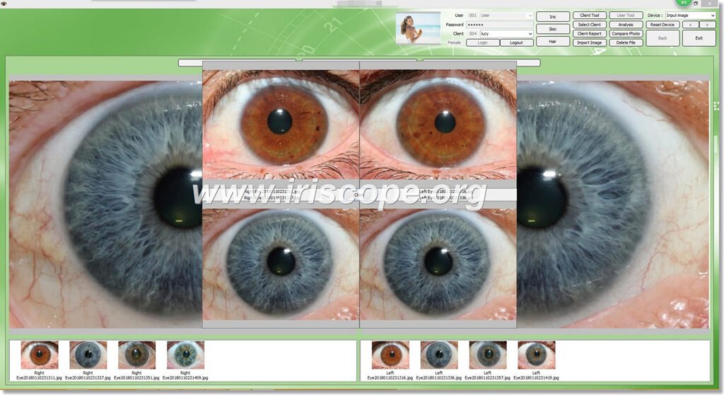 Digital Iriscope